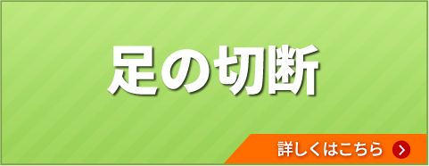 足の切断